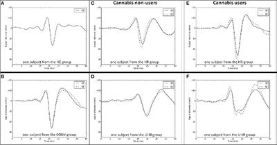 Early Somatosensory Processing Over Time in Individuals at Risk to Develop Psychosis